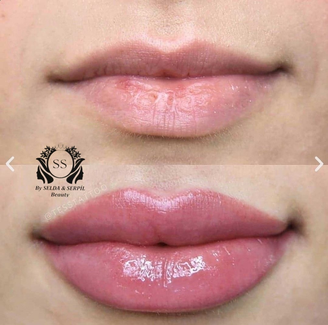 Neden Bizi Tercih Etmelisiniz?